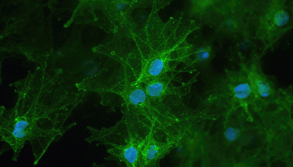 5614_GFAP stained astrocytes