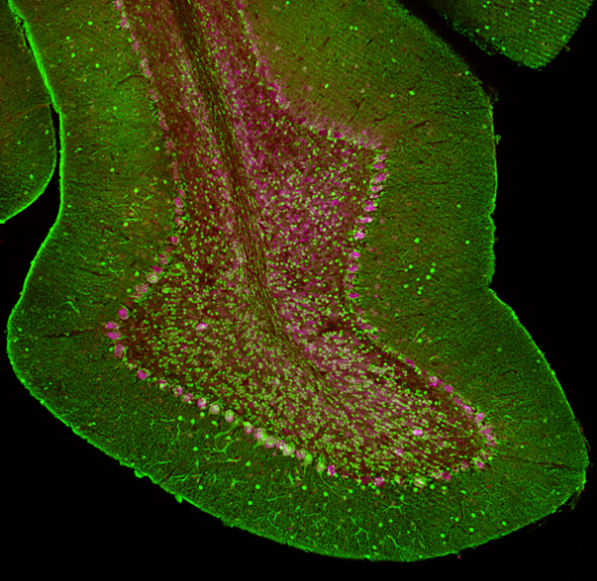 5616_Cerebellar folium IF