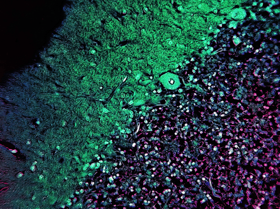 5617_Purkinje cells cerebellum, histology microscopic view neurons