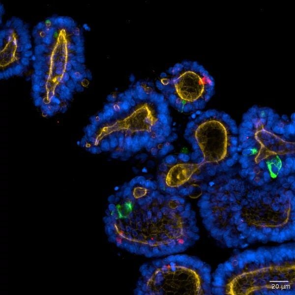 5704_Custom Photo_DS_NAMs_iPSC_Derived Intestinal Organoids HCI