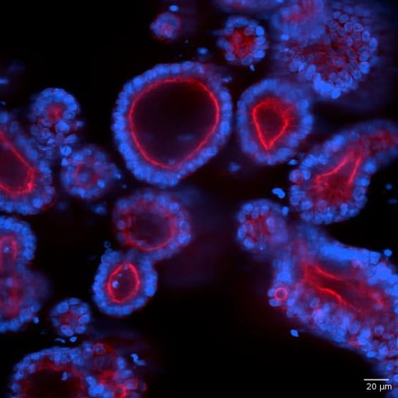 5718_Custom Photo_DS_Cellular_Morphology _Human_Intestinal_Organoid 2