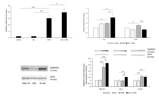 Dexrazoxane enhances efficacy of all-trans retinoic acid in acute myeloid leukemia patient blast cells and cell lines