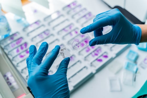 card-3263_Hand in blue glove holding glass histology slides