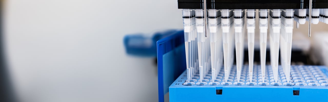 Automation in the clinical laboratory. Pipetting robot laboratory. Medicine robotics.