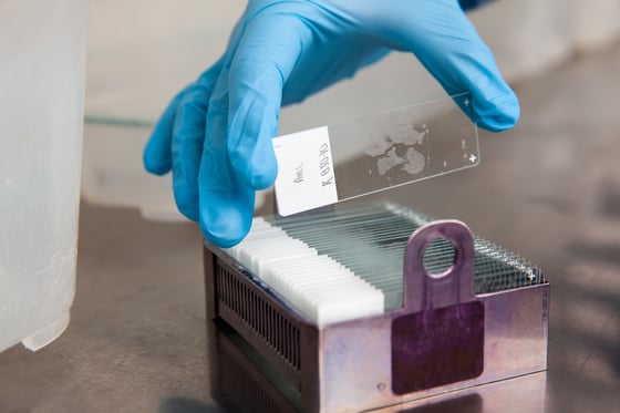 3277_Scientist placing slides with paraffin embedded tissue samples into a slide staining rack