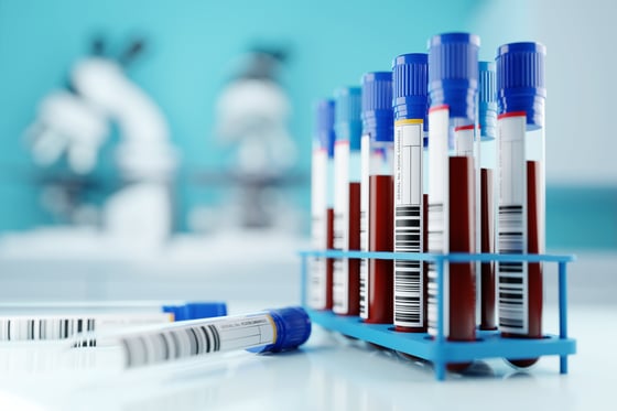 3239_A row of human blood samples in a medical laboratory ready to be tested