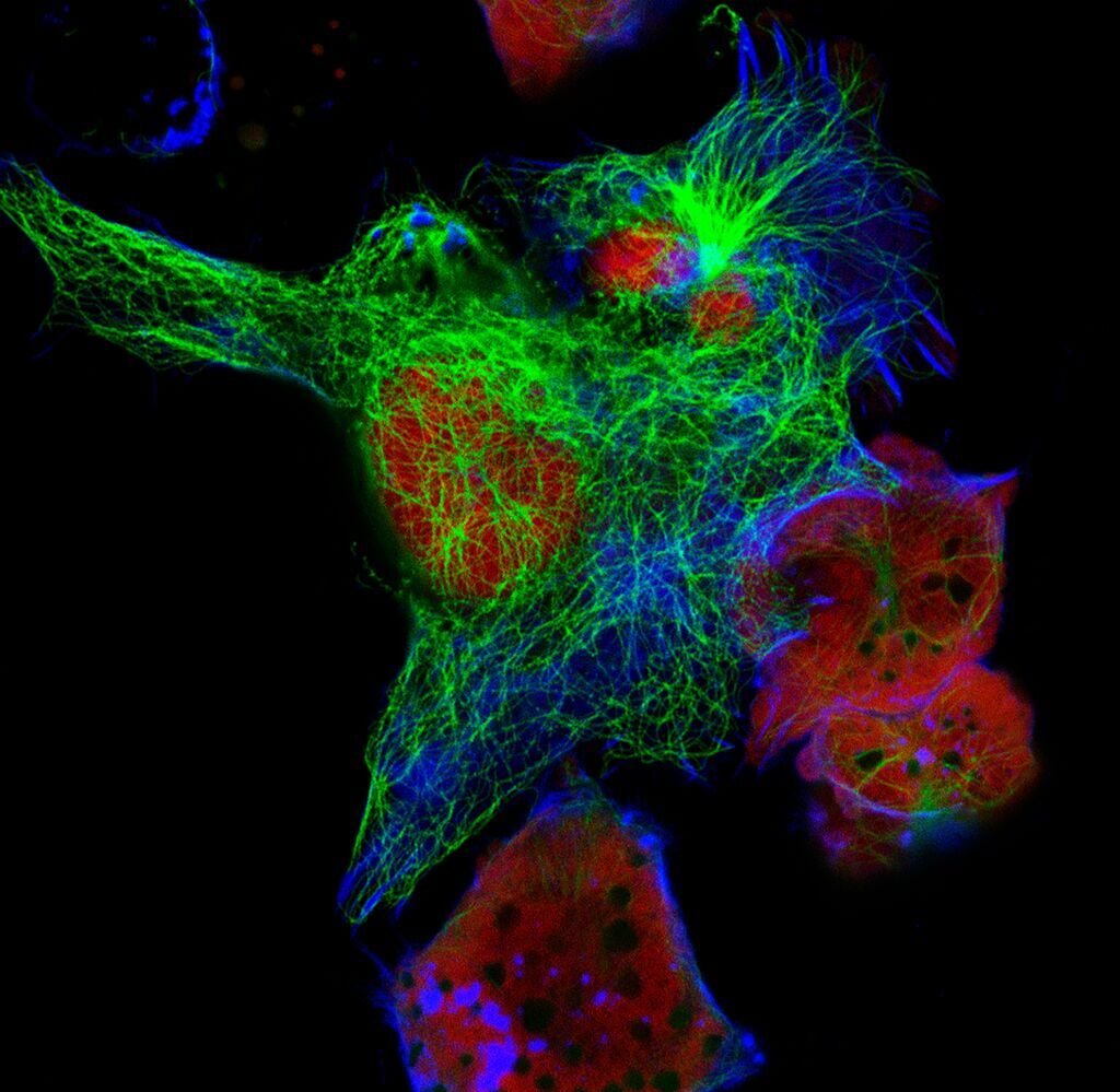 5618_Real fluorescence microscopic view of mice neuroblastoma cell line
