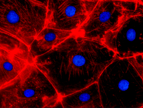 5619_Tumor immunofluorescence