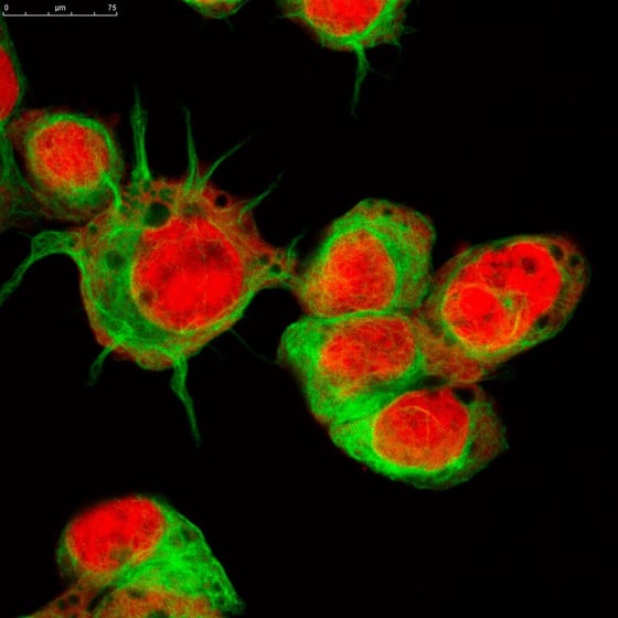 5623_Real fluorescence microscopic view of human neuroblastoma cells
