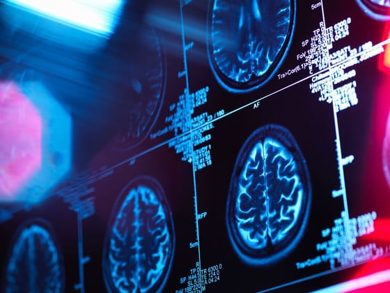 175_Human brain scan in neurology clinic