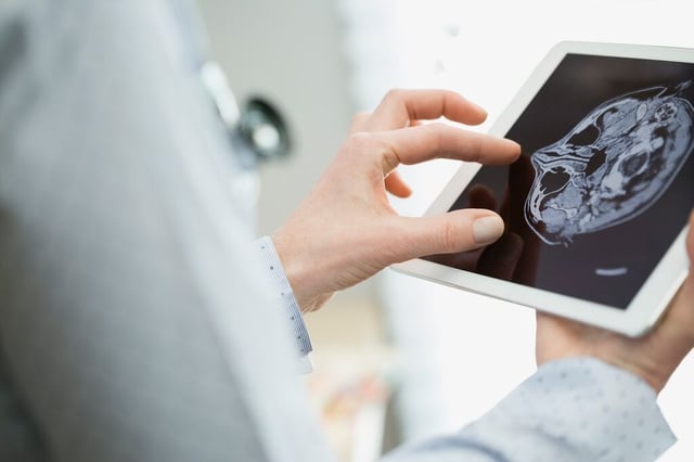 226_Female doctor examining brain scan on tablet
