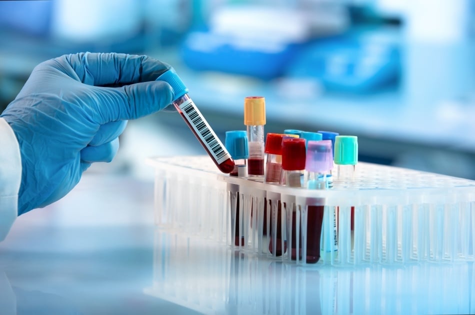 card-3241_Technician holding blood tube test in the research laboratory